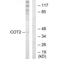 Anti-COT2 Antibody