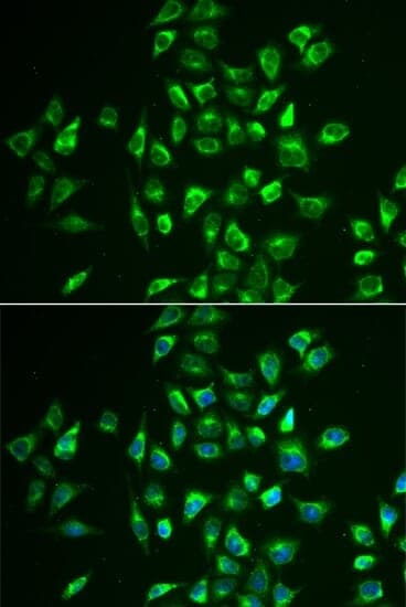 Anti-LNX1 Antibody