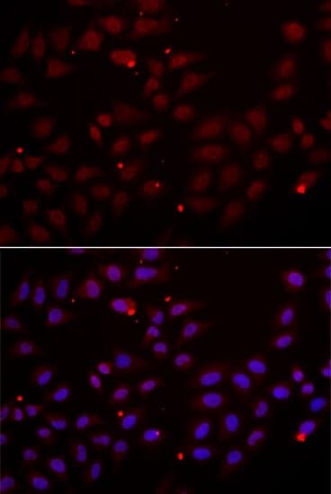 Anti-CST2 Antibody