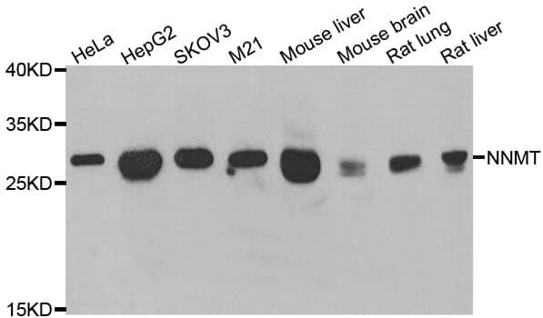 Anti-NNMT Antibody