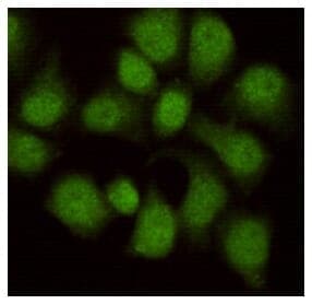 Anti-WDR77 Antibody