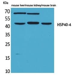 Anti-HSP40-4 Antibody