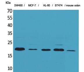 Anti-FGF-20 Antibody