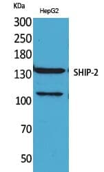 Anti-SHIP-2 Antibody
