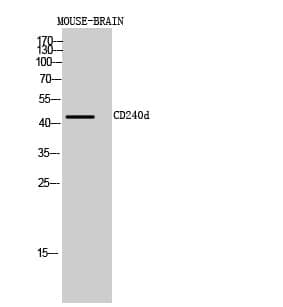 Anti-CD240d Antibody