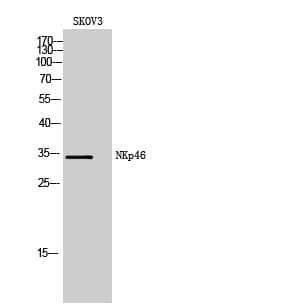 Anti-NKp46 Antibody