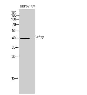 Anti-Lefty Antibody