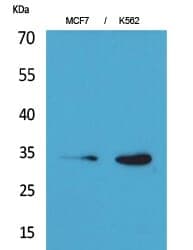 Anti-Cdk4 Antibody