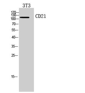 Anti-CD21 Antibody
