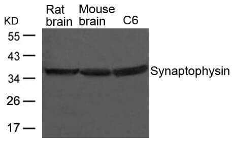 Anti-Synaptophysin Antibody