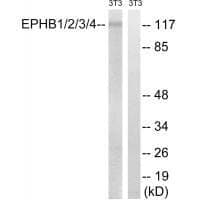 Anti-EPHB1 / 2 / 3 / 4 (Ab-600 / 602 / 614 / 596) Antibody