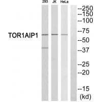 Anti-TOR1AIP1 Antibody
