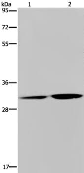 Anti-DNASE1L3 Antibody