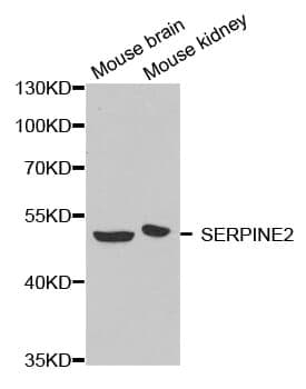 Anti-SERPINE2 Antibody