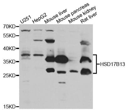 Anti-HSD17B13 Antibody
