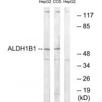 Anti-ALDH1B1 Antibody