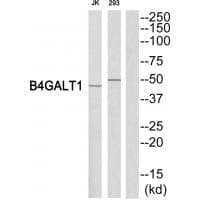Anti-B4GALT1 Antibody