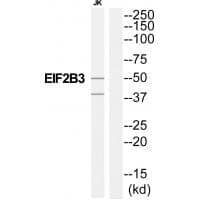 Anti-EIF2B3 Antibody