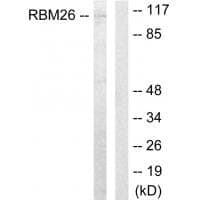 Anti-RBM26 Antibody