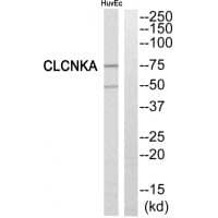 Anti-CLCNKA Antibody