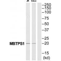 Anti-MBTPS1 Antibody