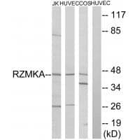 Anti-RIMKA Antibody