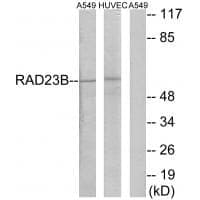 Anti-RAD23B Antibody