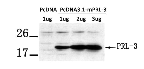 Anti-PRL-3 Antibody