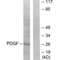 Anti-PDGFB Antibody