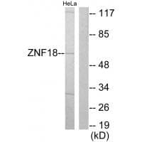 Anti-ZNF18 Antibody