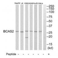 Anti-BCAS2 Antibody