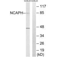 Anti-NCAPH Antibody