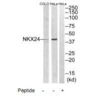 Anti-NKX24 Antibody