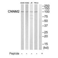 Anti-CNNM2 Antibody