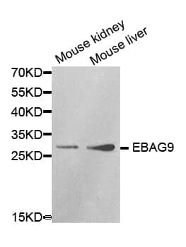 Anti-EBAG9 Antibody