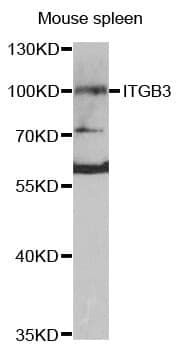 Anti-ITGB3 Antibody