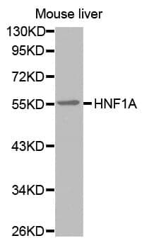 Anti-HNF1A Antibody