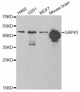 Anti-GAP43 Antibody