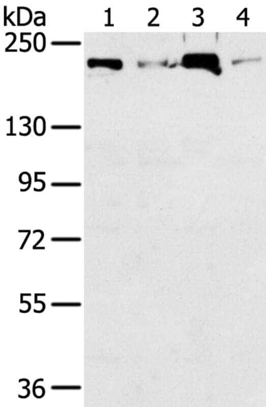Anti-TOP2B Antibody