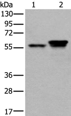 Anti-ACVR1 Antibody
