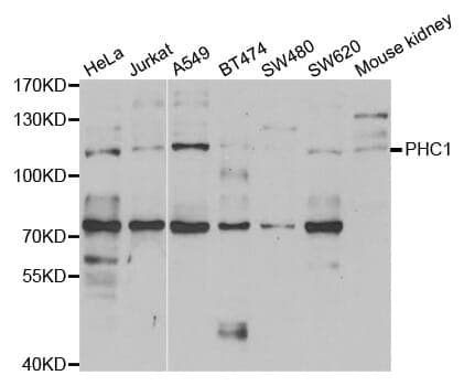 Anti-PHC1 Antibody