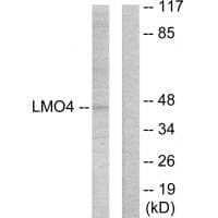 Anti-LMO4 Antibody