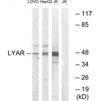 Anti-LYAR Antibody
