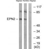 Anti-EPN2 Antibody