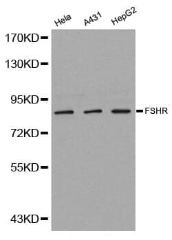 Anti-FSHR Antibody