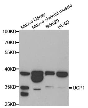 Anti-UCP1 Antibody