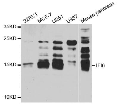 Anti-IFI6 Antibody