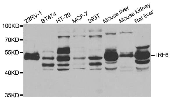 Anti-IRF6 Antibody