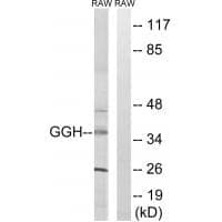 Anti-GGH Antibody