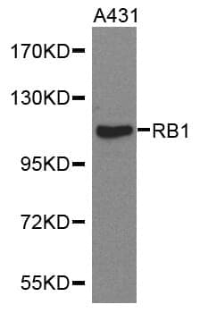 Anti-RB1 Antibody